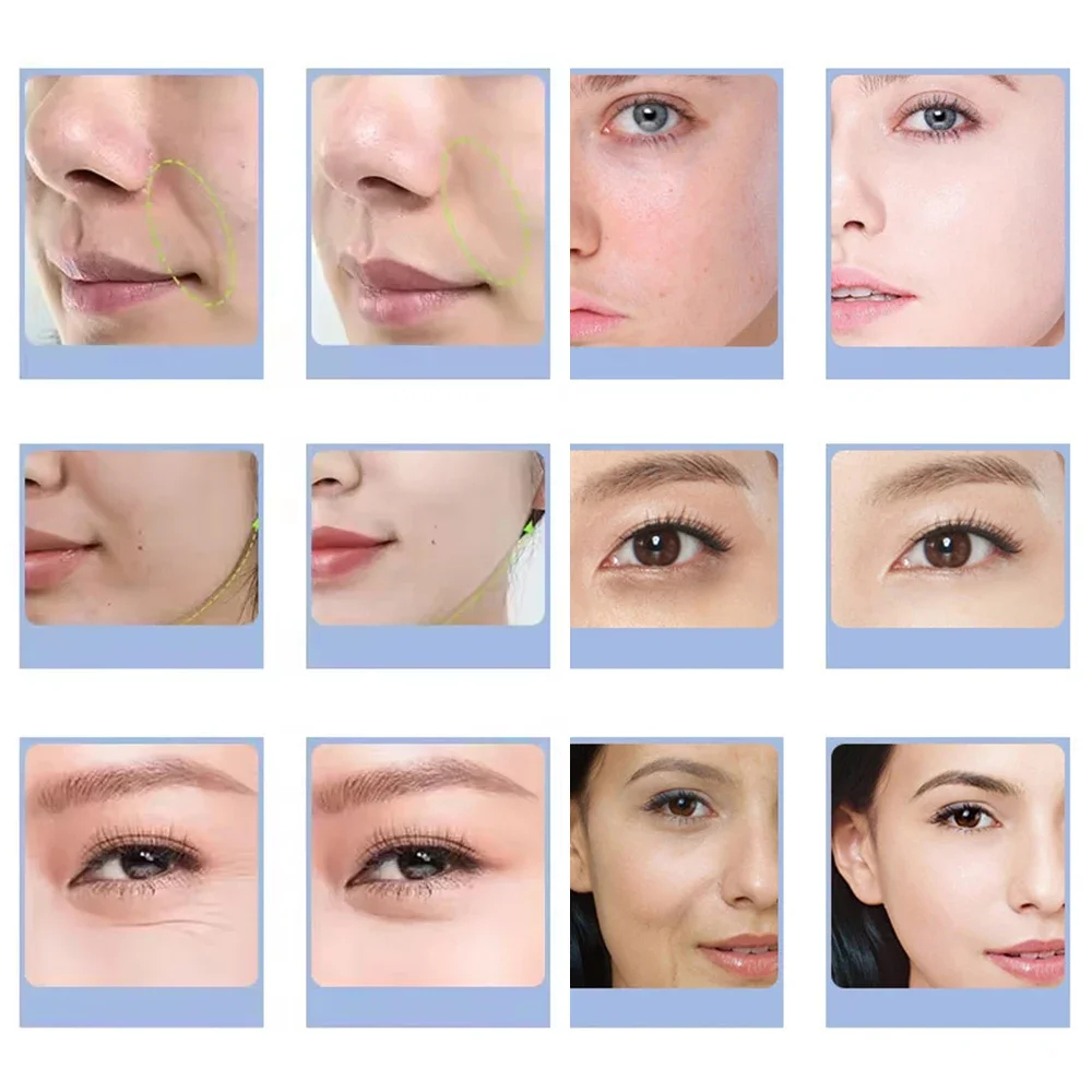 7가지 유형의 얼굴 CO2 산소 버블 머신 산소젯 스파 - Spa Y Wellness 리뷰 및 가격